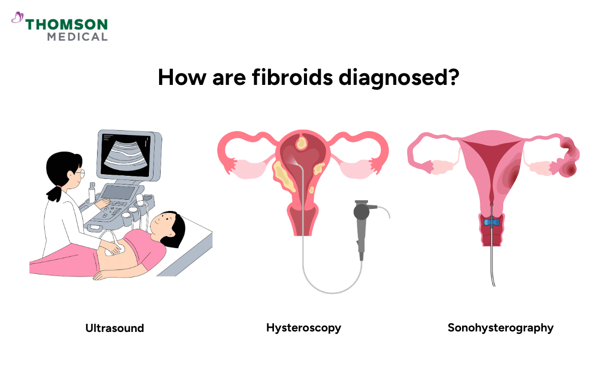 illustration on how are fibroids diagnosed