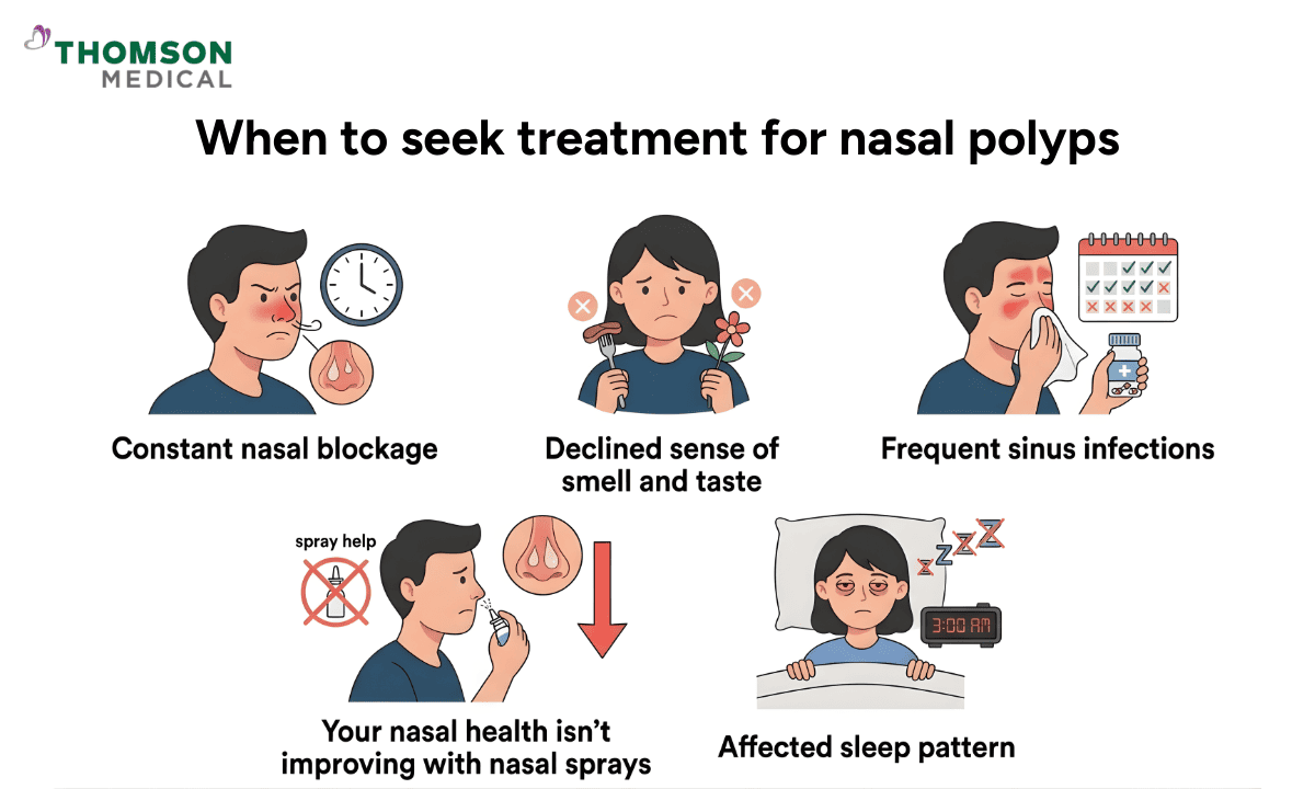 An infographic on when to seek treatment for nasal polyps, illustrating five signs: constant nasal blockage, declined sense of smell and taste, frequent sinus infections, lack of improvement with nasal sprays, and affected sleep patterns.