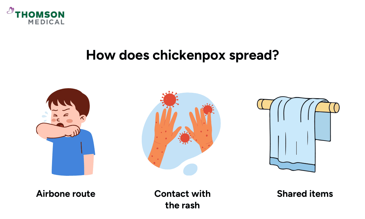 An infographic on how chickenpox spreads