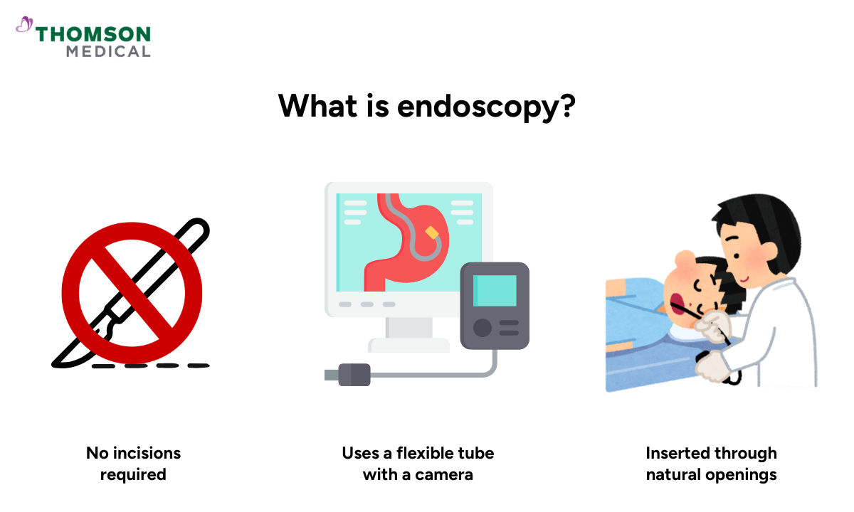 Illustration of what endoscopy is