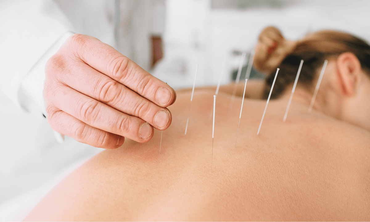 woman performing acupuncture on her back