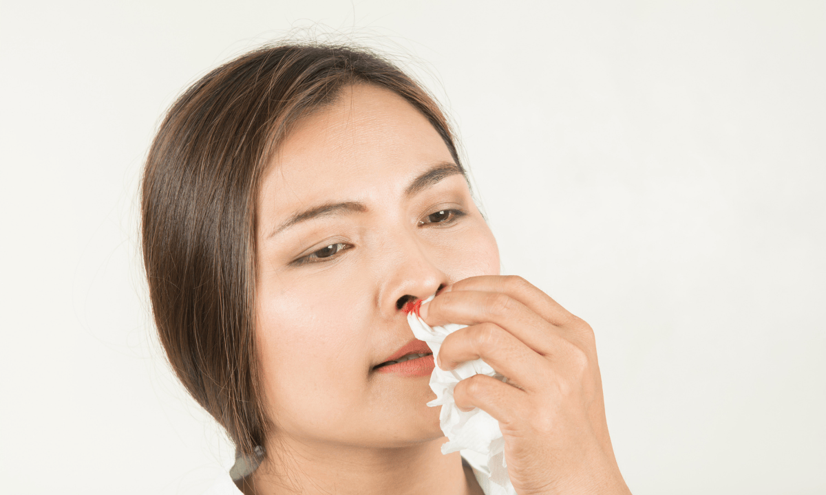 image of women with a bleeding nose
