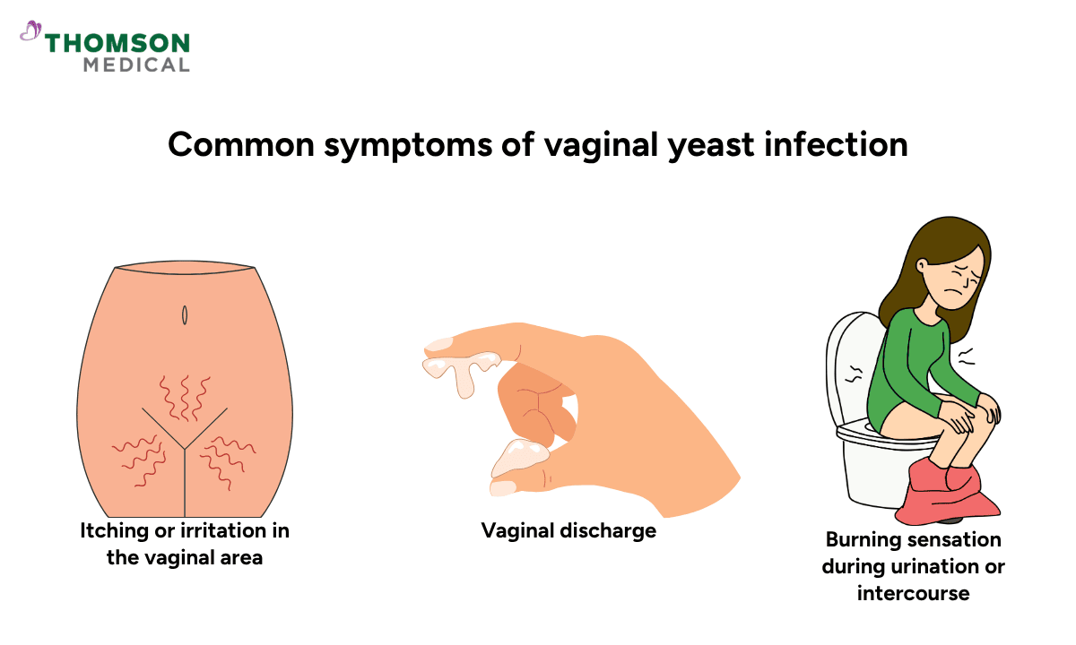 blog-image_obgyn_vaginal-yeast-symptoms.png