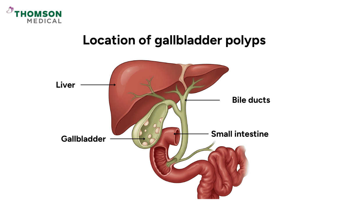 An anatomical diagram showing the location of the gallbladder in relation to the liver, bile ducts, and small intestine.