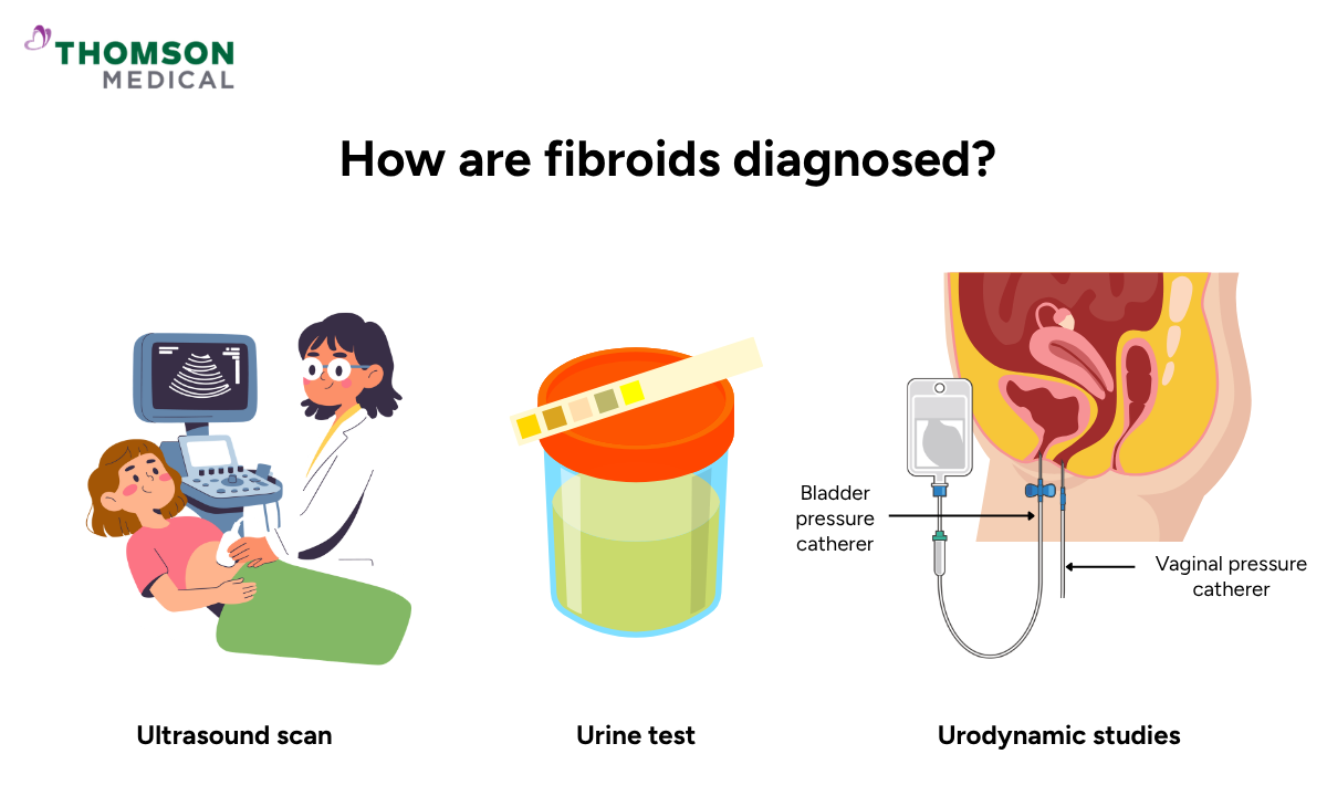 Illustration how fibroids are diagnosed