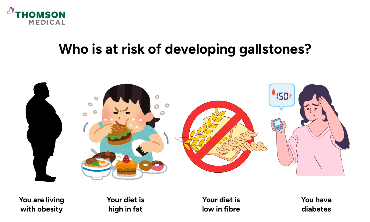 Illustration showing who is at risk of developing gallstones