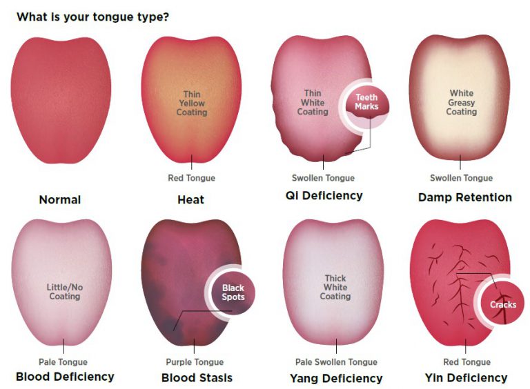 tongue colour