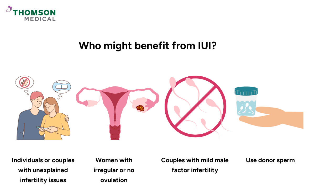 blog-image_obgyn_who-benefits-from-iui  .png