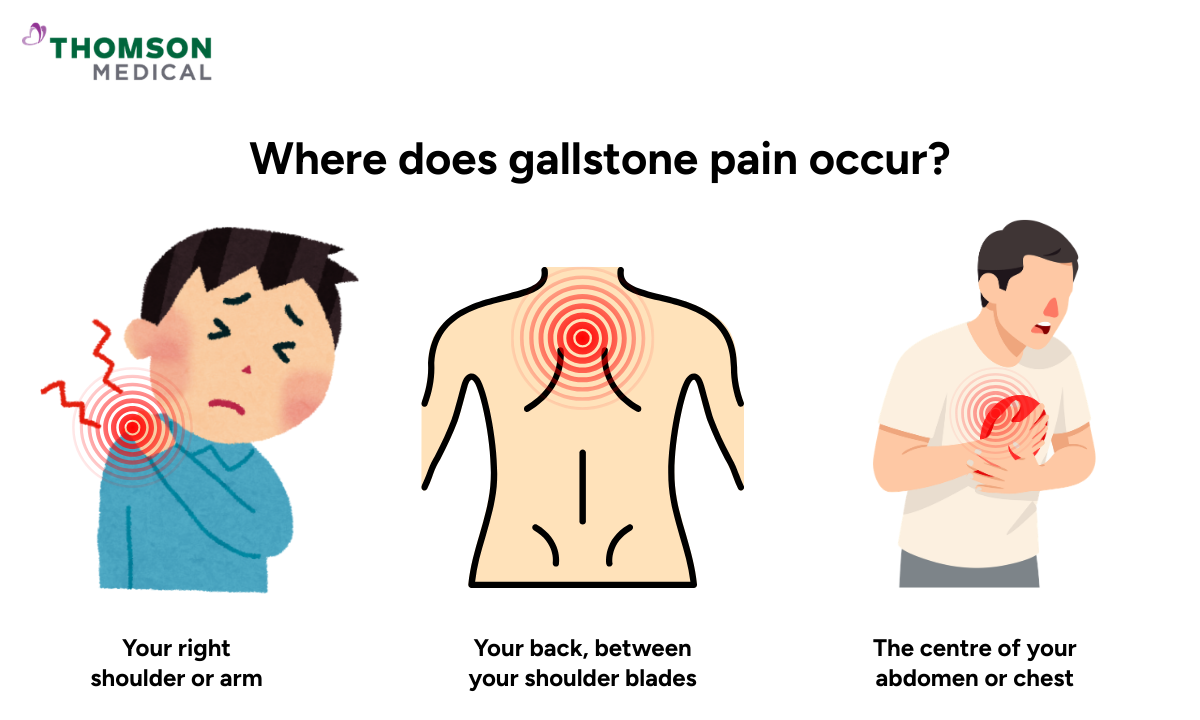 Illustration of the location of gallstone pain