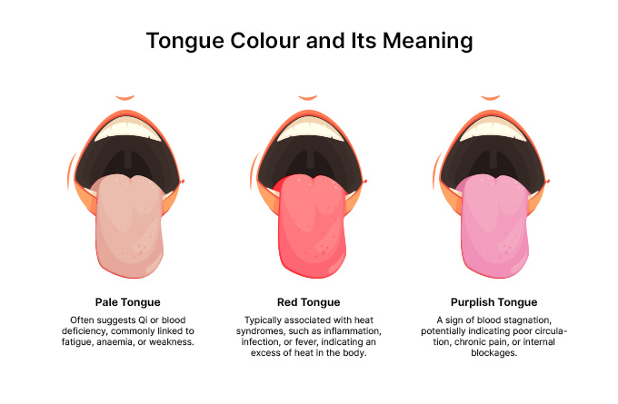 DIfferent tongue colour and its diagnostics