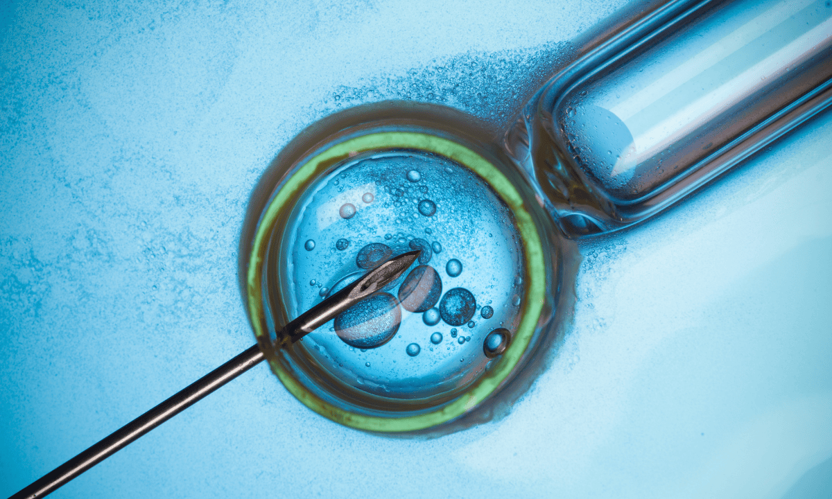 image of the IVF procedure