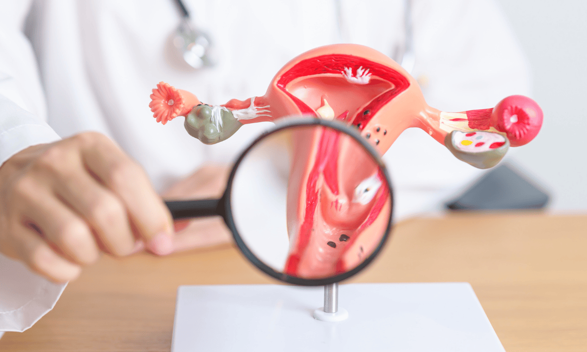 Illustration of a focused image of the cervix anatomy