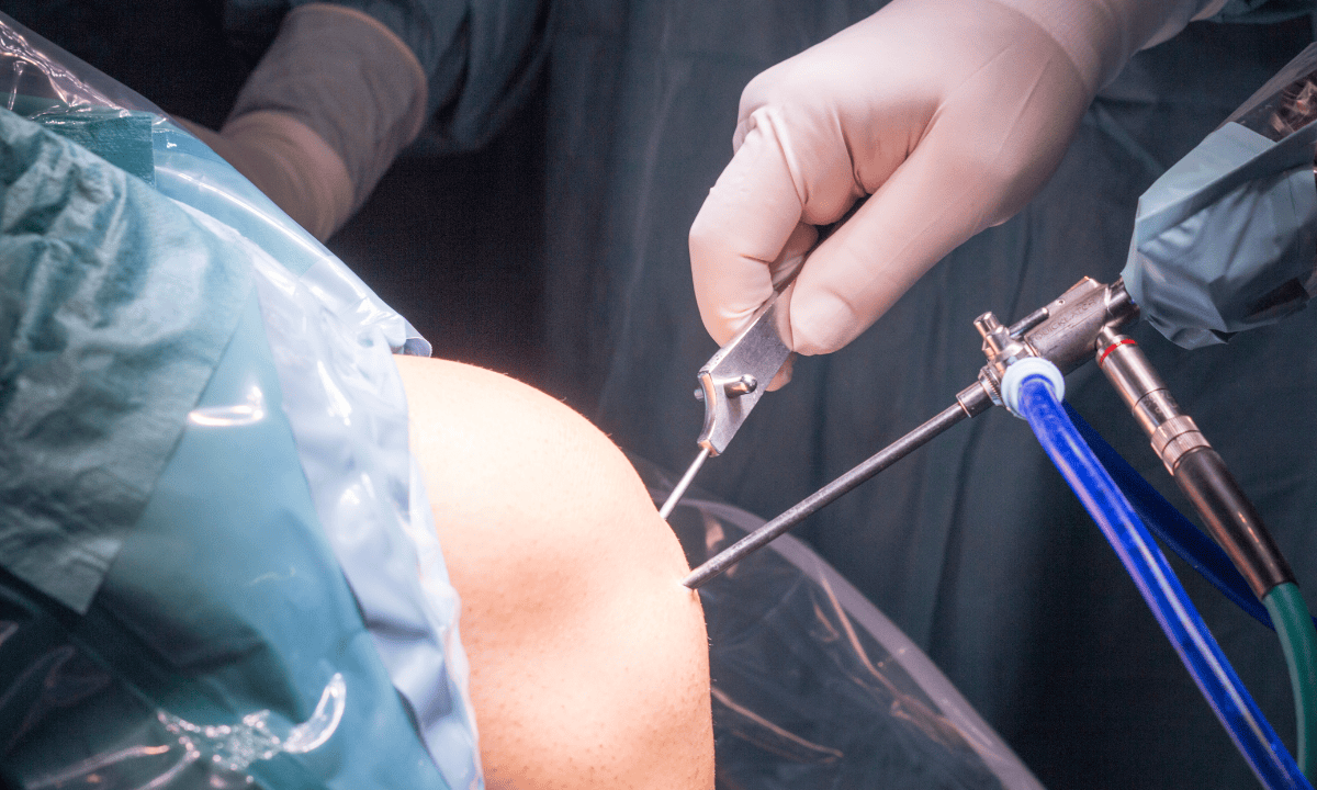 blog-image_meniscus-surgical-procedure.png