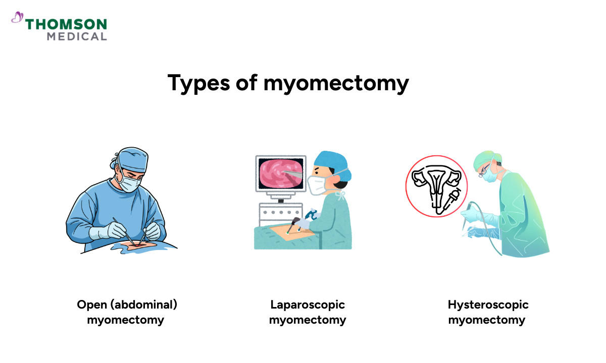Different types of myomectomy