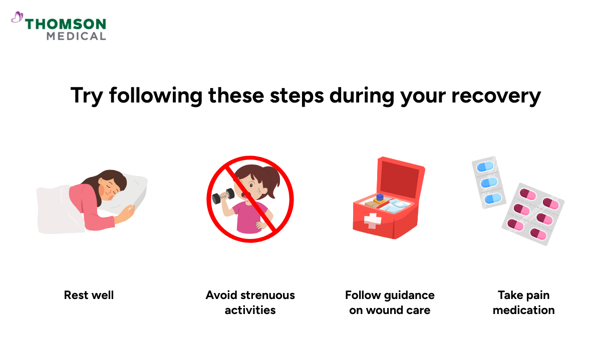 Illustration of steps which can help during cystectomy recovery