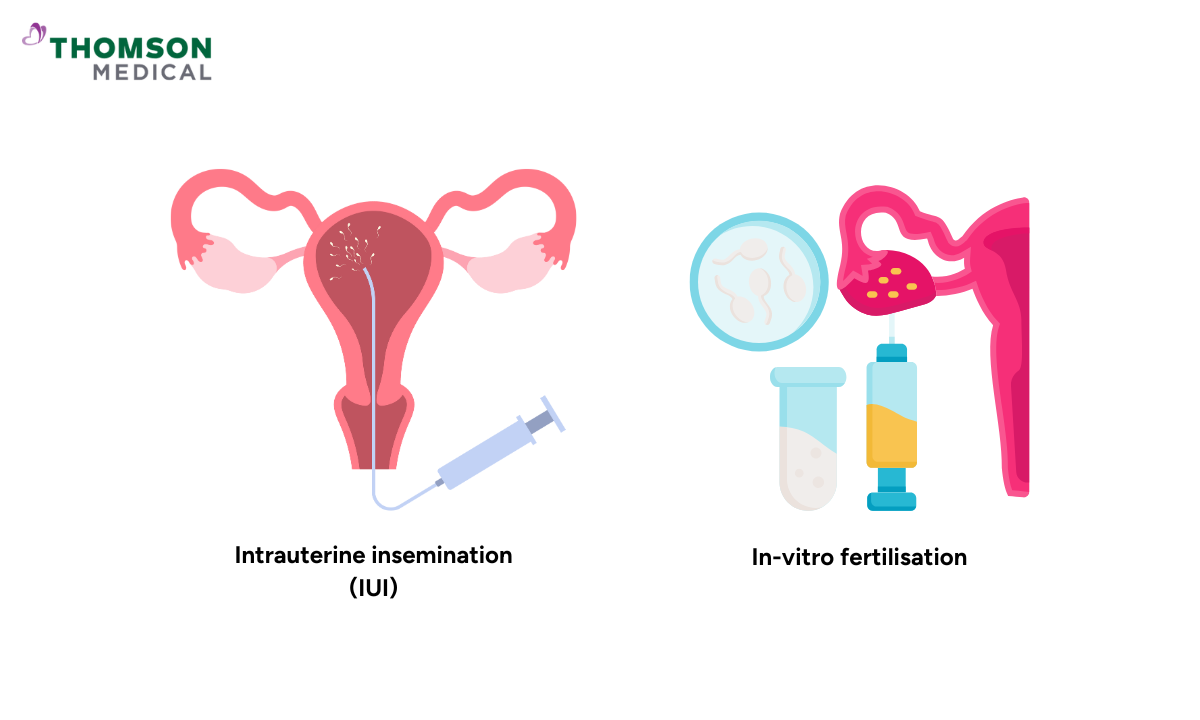blog-image_obgyn_iui-vs-ivf.png