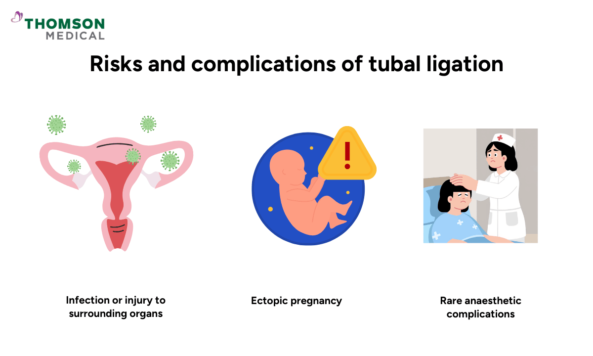 tubal-ligation-risks