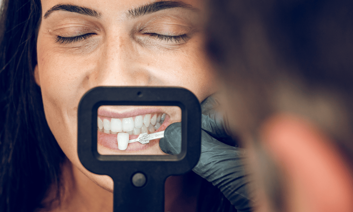 A woman getting preparation for dental veneers