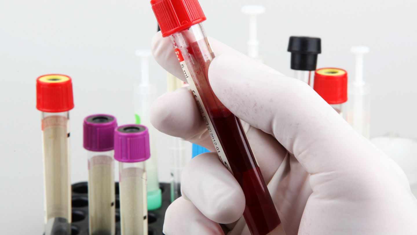 Thalassaemia Test: Everything You Need To Know | Thomson Medical