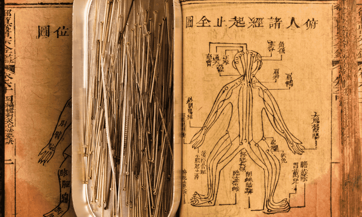 A silver tray of acupuncture needles resting on an open vintage manuscript showing a human meridian chart.
