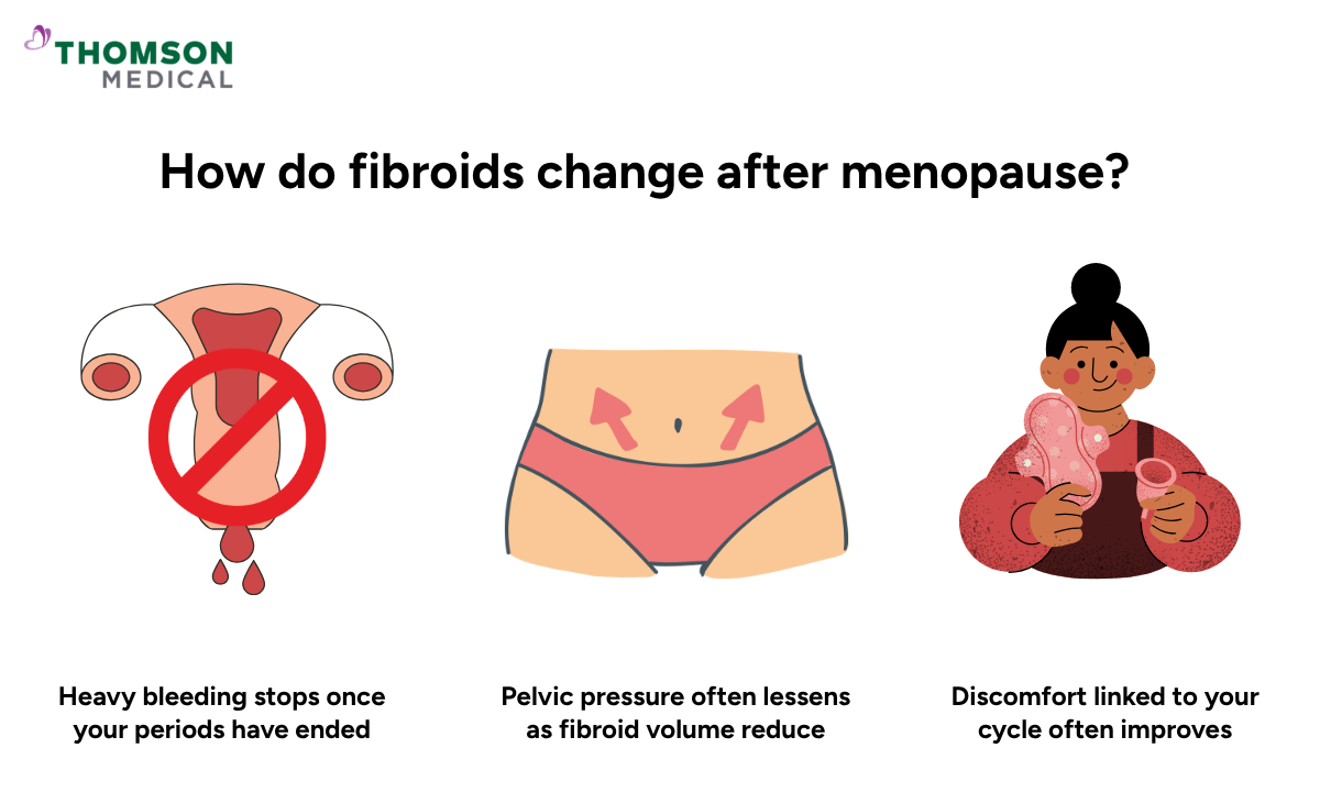 Illustration shows how do fibroids change after menopause