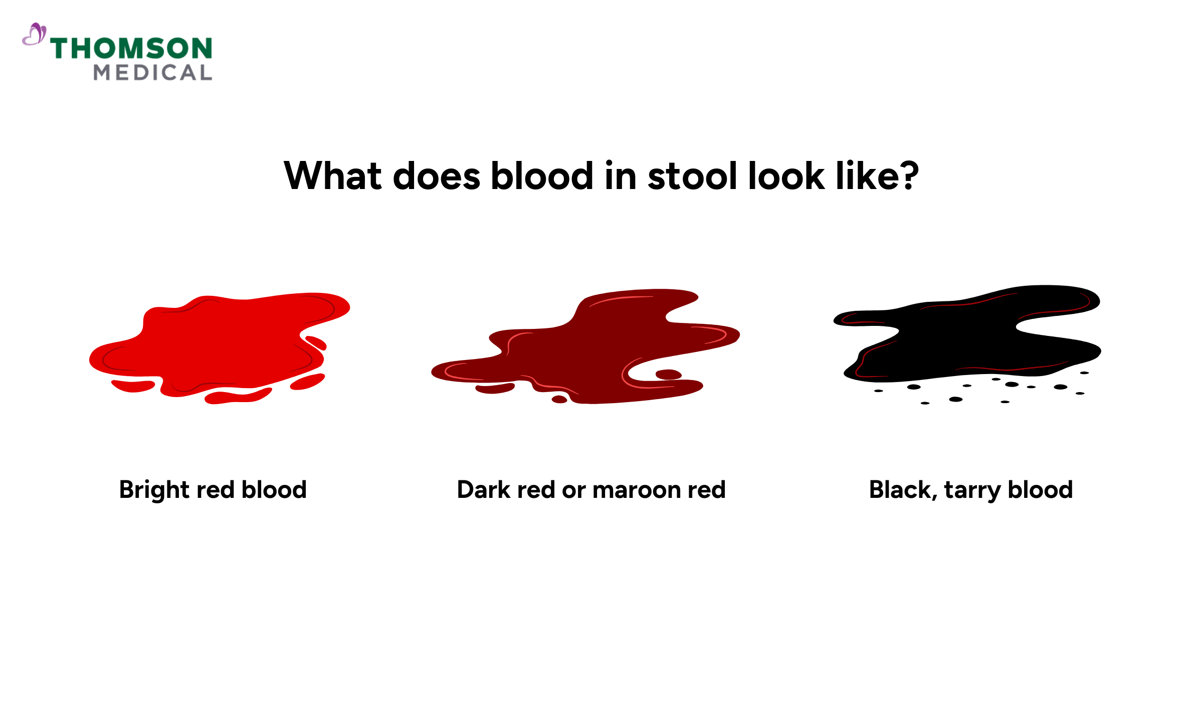 blood in poop colour