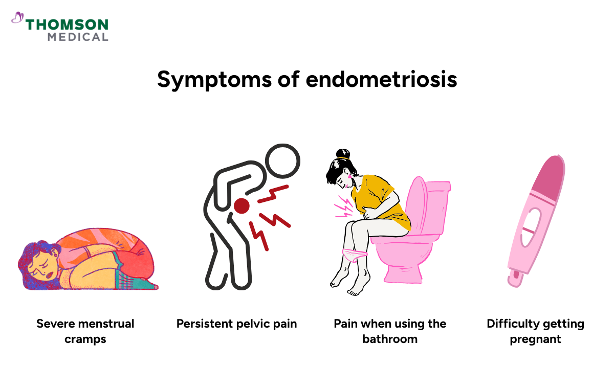 Illustration of symptoms of endometriosis