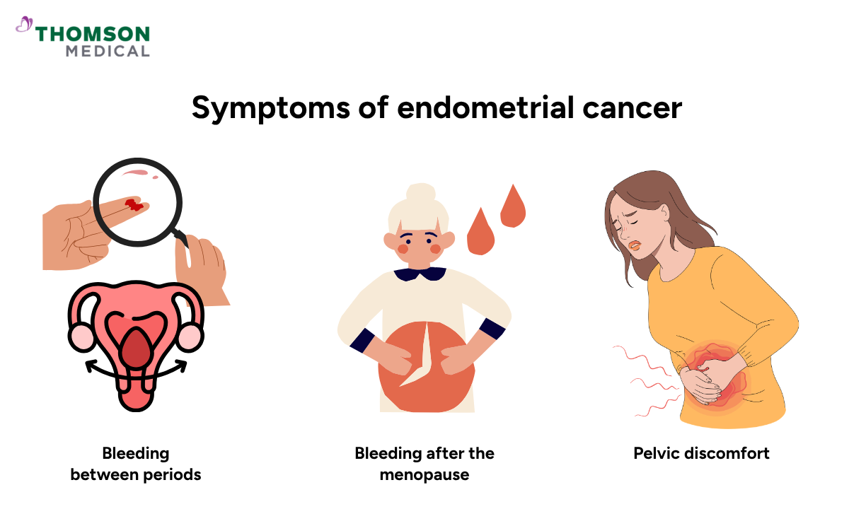 Illustration shows the symptoms of endometrial cancer