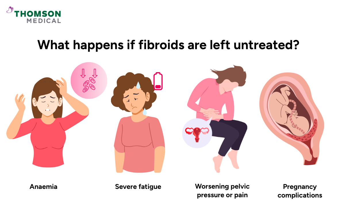 Illustration shows what happens if fibroids are left untreated