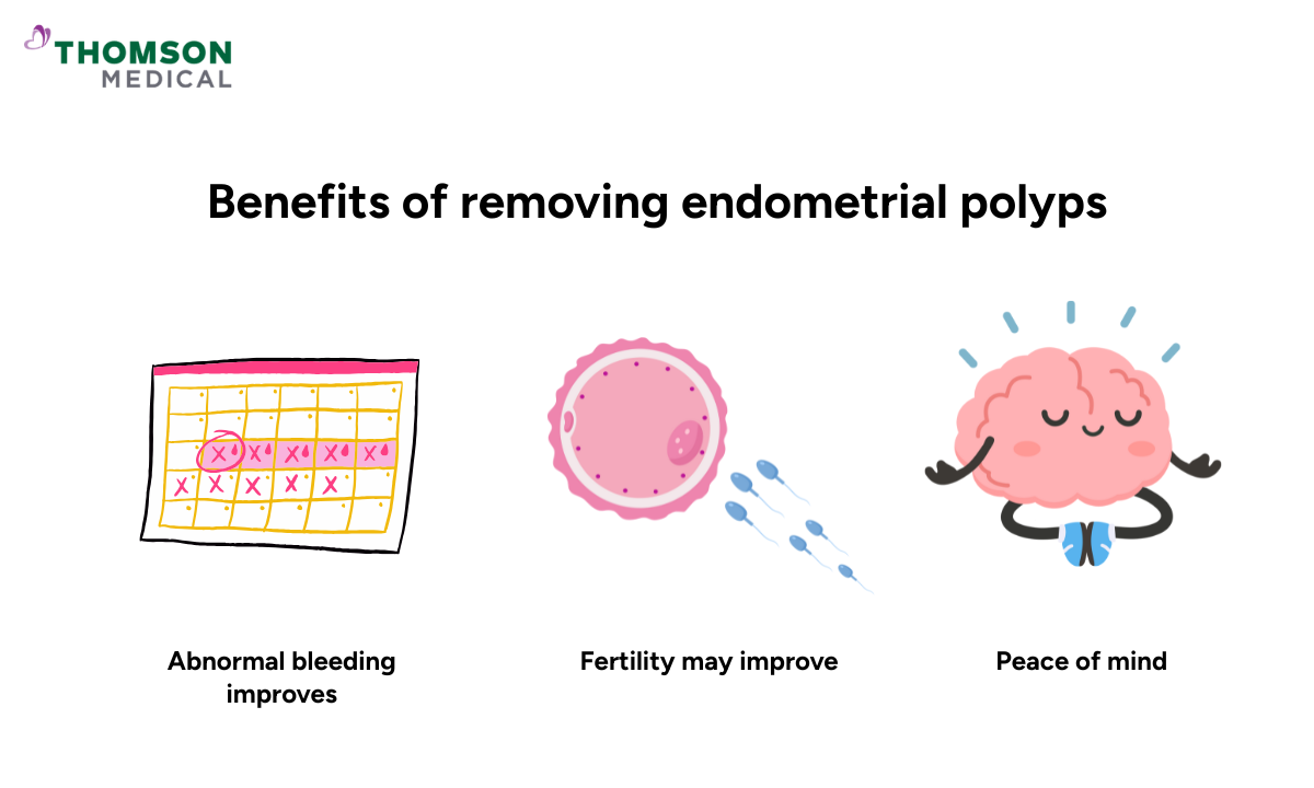 Illustration of benefits of endometrial polypectomy