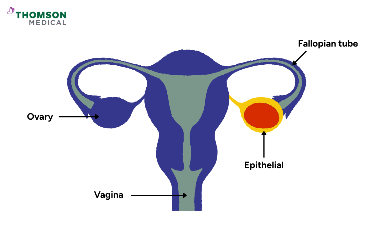 Illustration showing the anatomy of the ovary