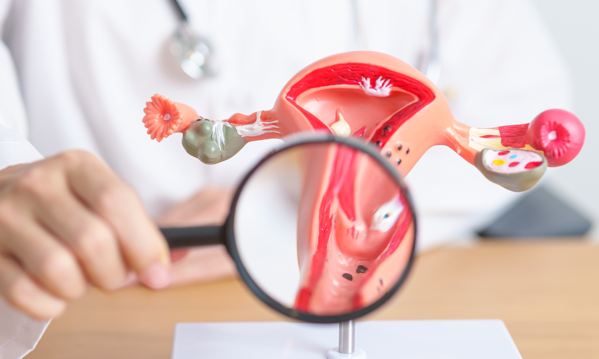 Illustration of a uterus