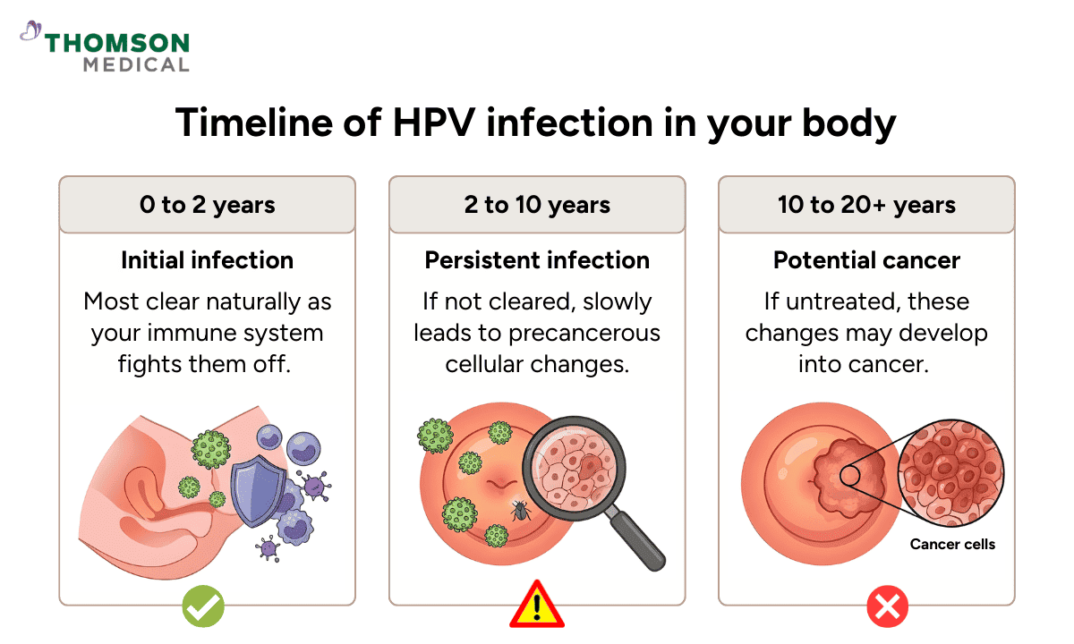 An infographic outlining the timeline of an HPV infection, ranging from initial infection (0-2 years) to persistent infection (2-10 years) and potential cancer development (10-20+ years).