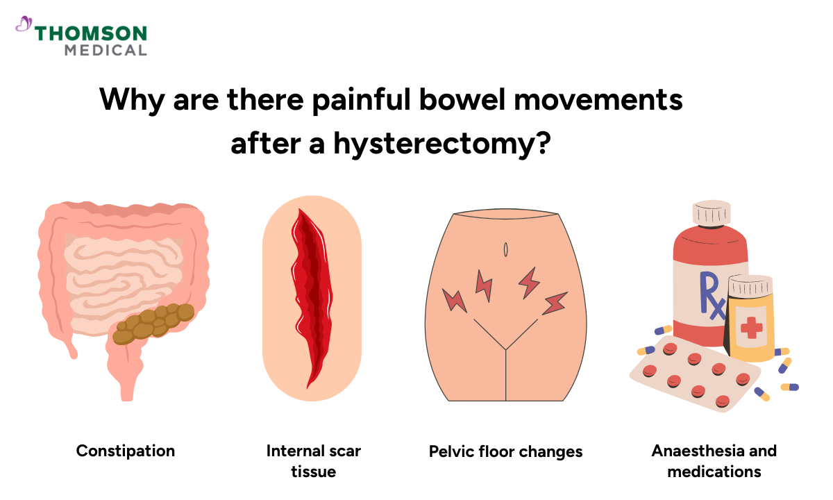 Illustration of why there are painful bowel movements after a hysterectomy