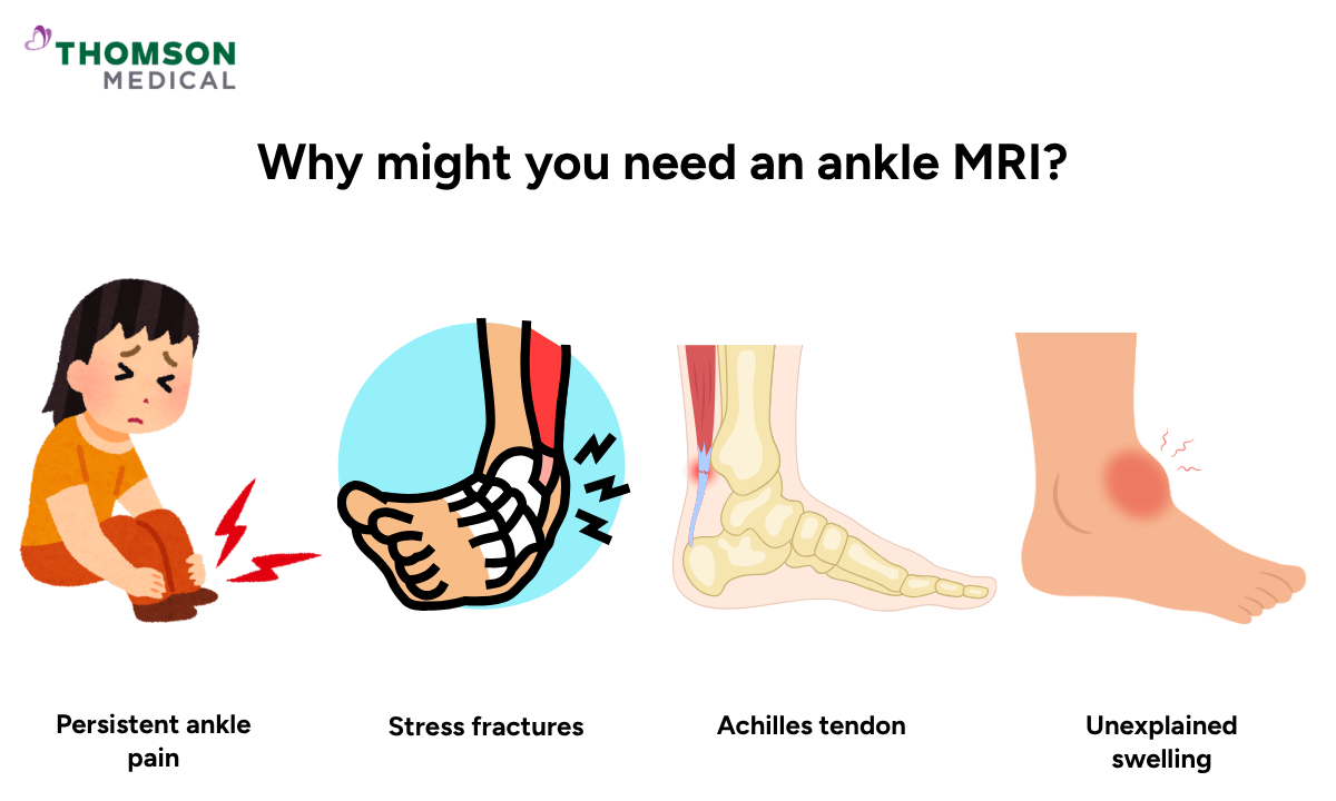 Illustration of why your doctor might recommend an ankle MRI