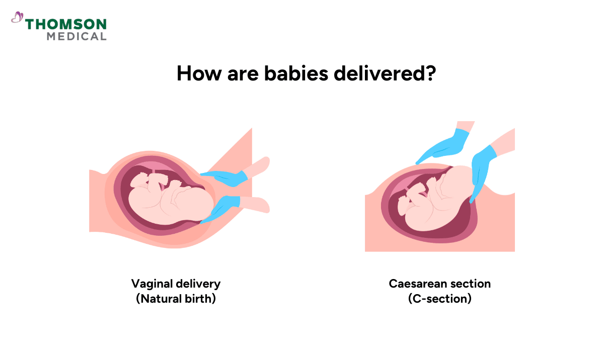 Illustration of how are babies delivered