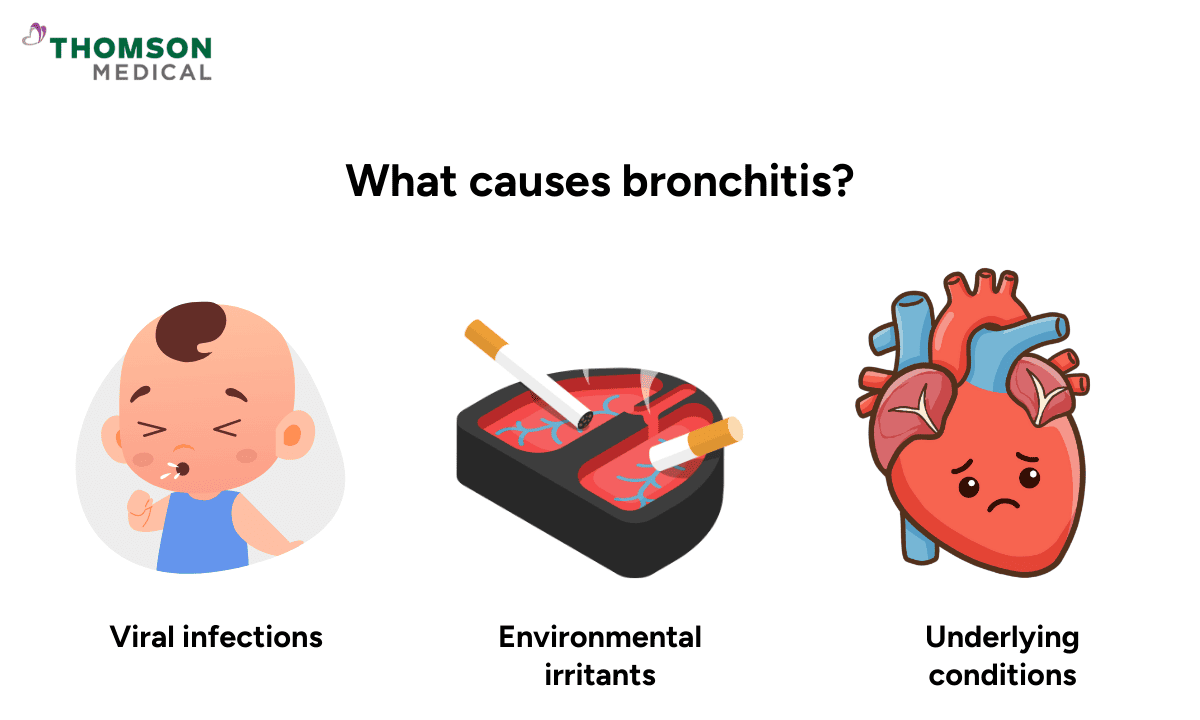 Infographic showing causes of bronchitis: viral infections, environmental irritants, and underlying conditions.