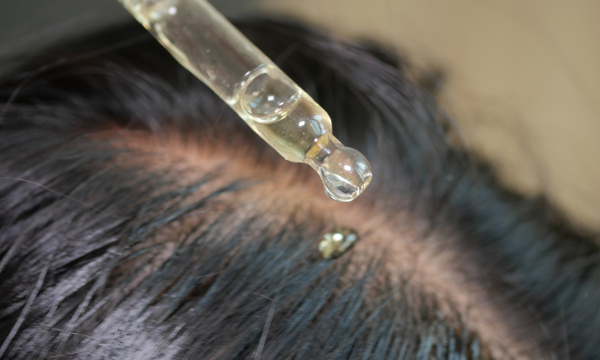 A glass dropper applying a golden scalp serum or oil directly onto the parting of dark hair.