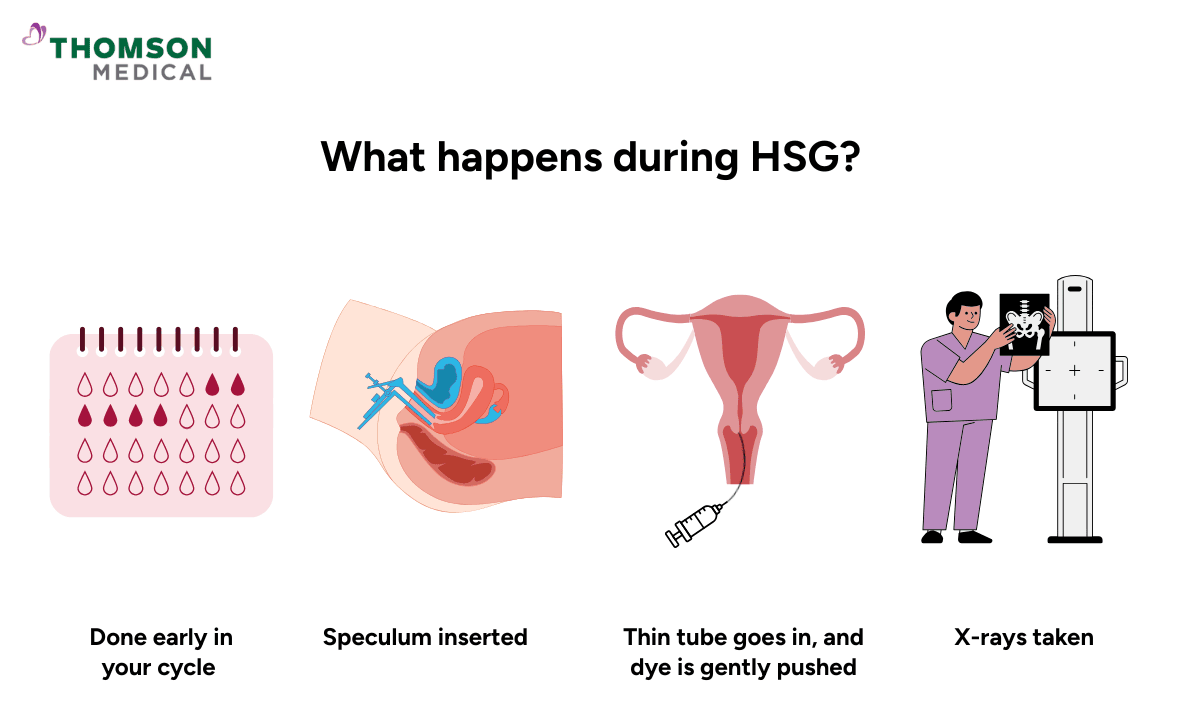 What happens during HSG?