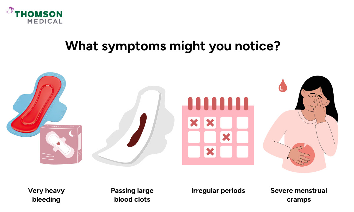 Illustration of the symptoms might you notice when you have fibroids