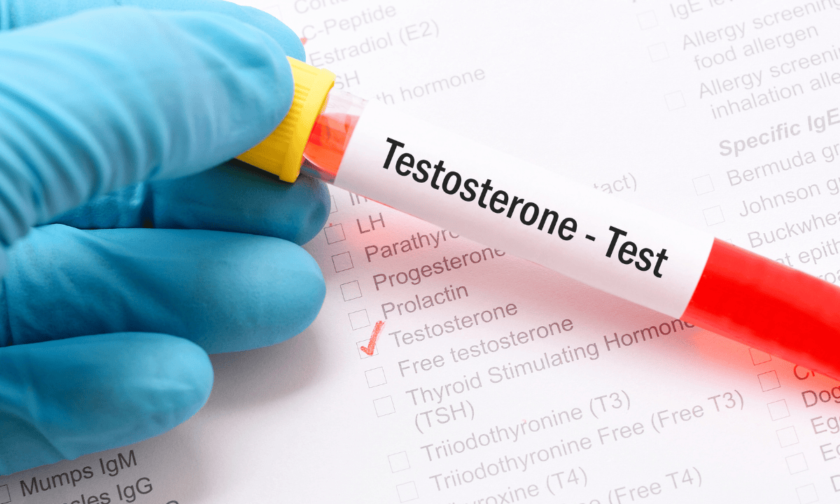 image of testosterone test result