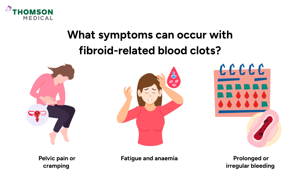 Illustration shows the symptoms can occur with fibroid-related blood clots