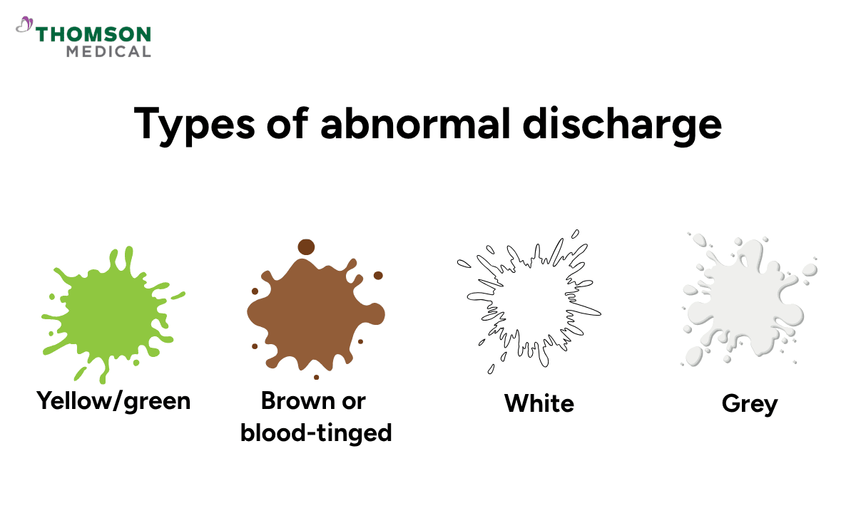 blog-image_obgyn_abnormal discharge-colours.png