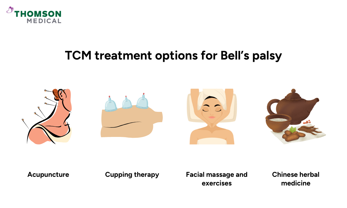 illustration of tcm treatment for bells palsy