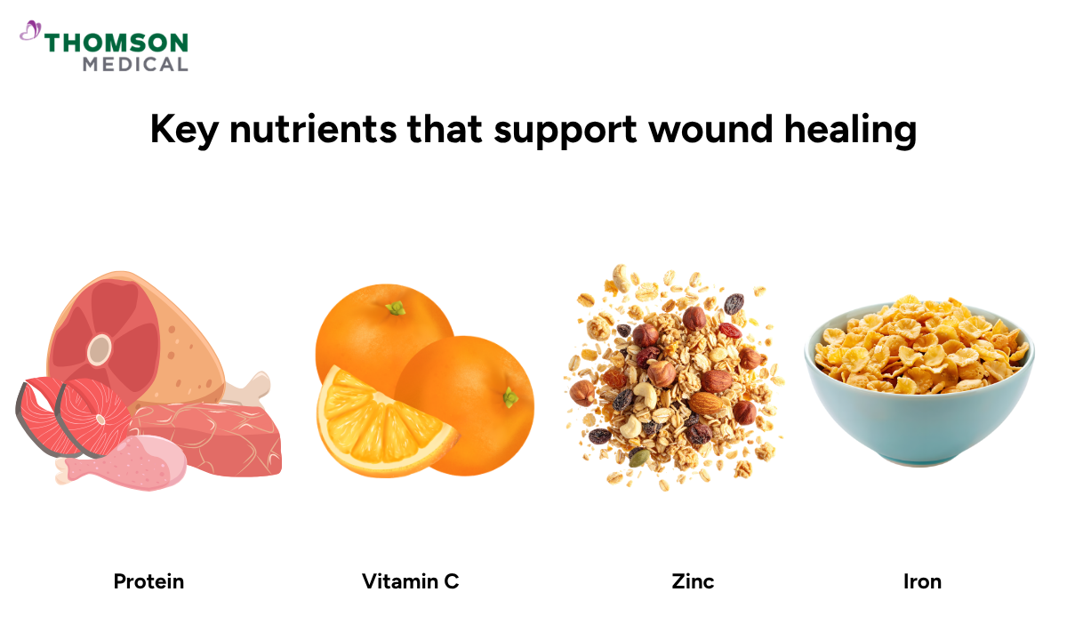 Illustration of key nutrients that support wound healing