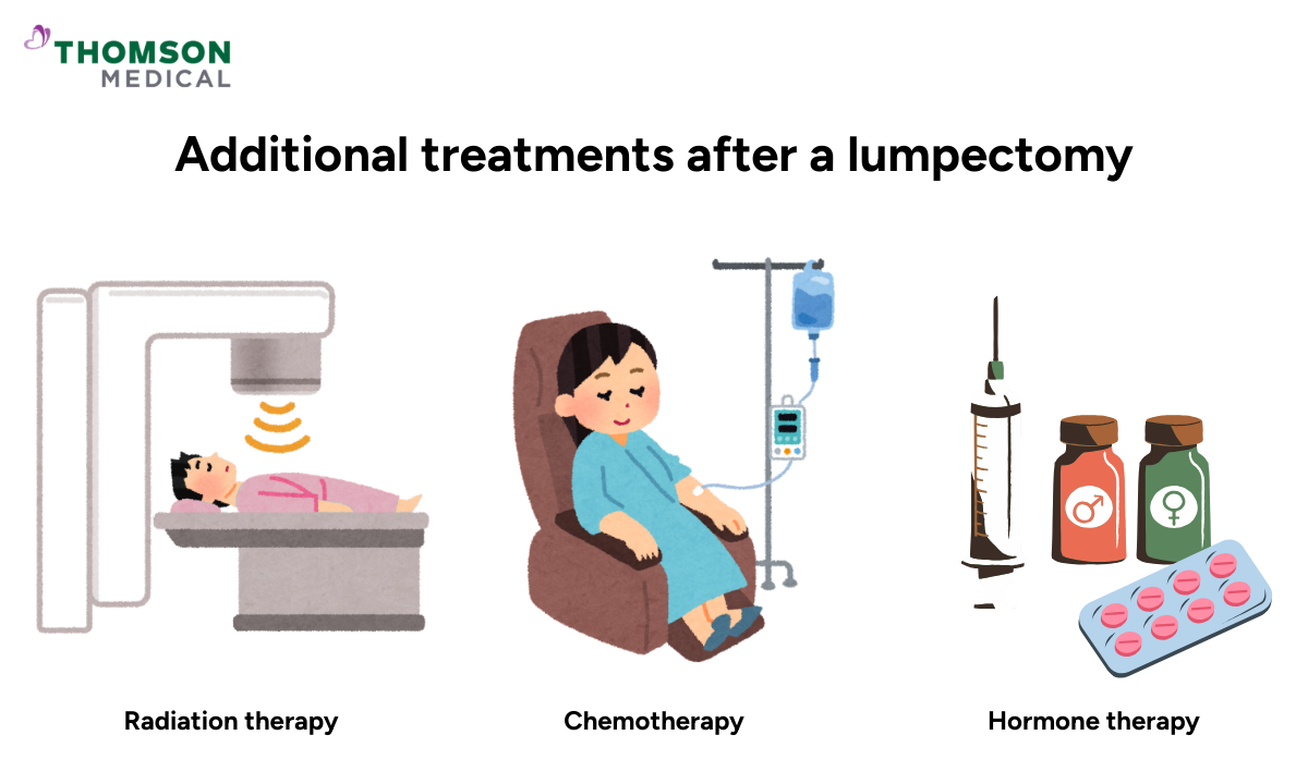Illustration of additional treatments after a lumpectomy