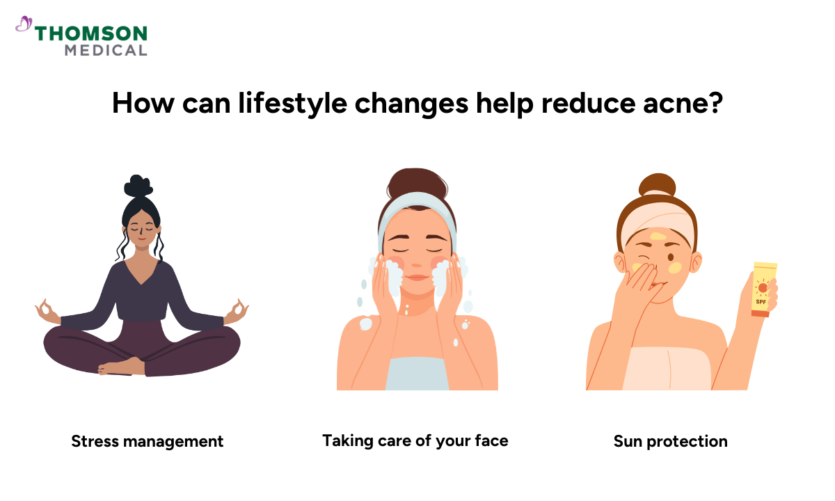 how can lifestyle changes help reduce acne