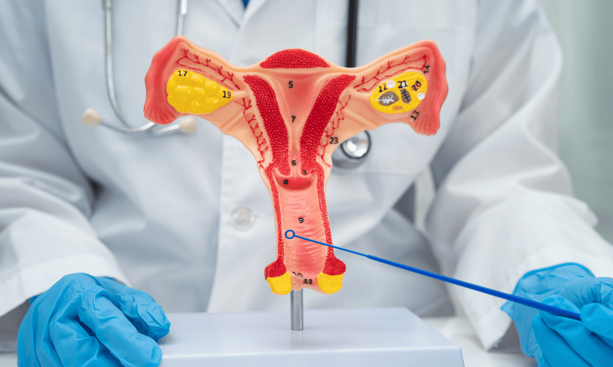 image of image of female reproductive anatomy