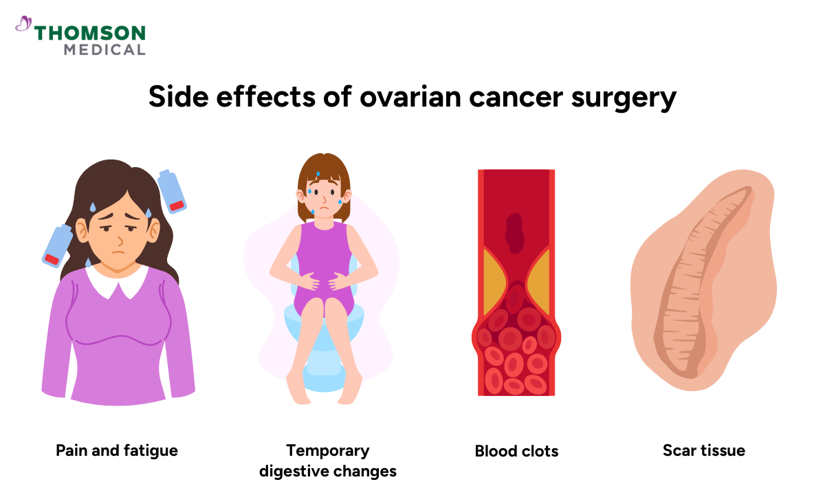 Illustration of side effects of ovarian cancer surgery