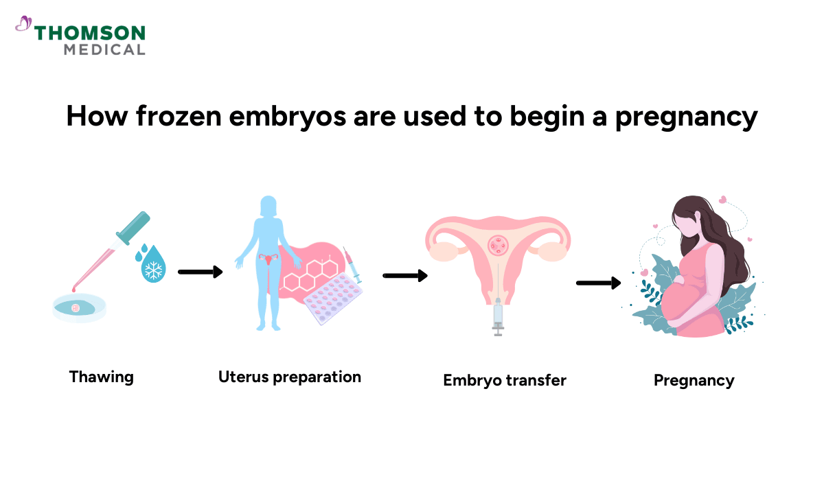 How frozen embryos are used to begin a pregnancy